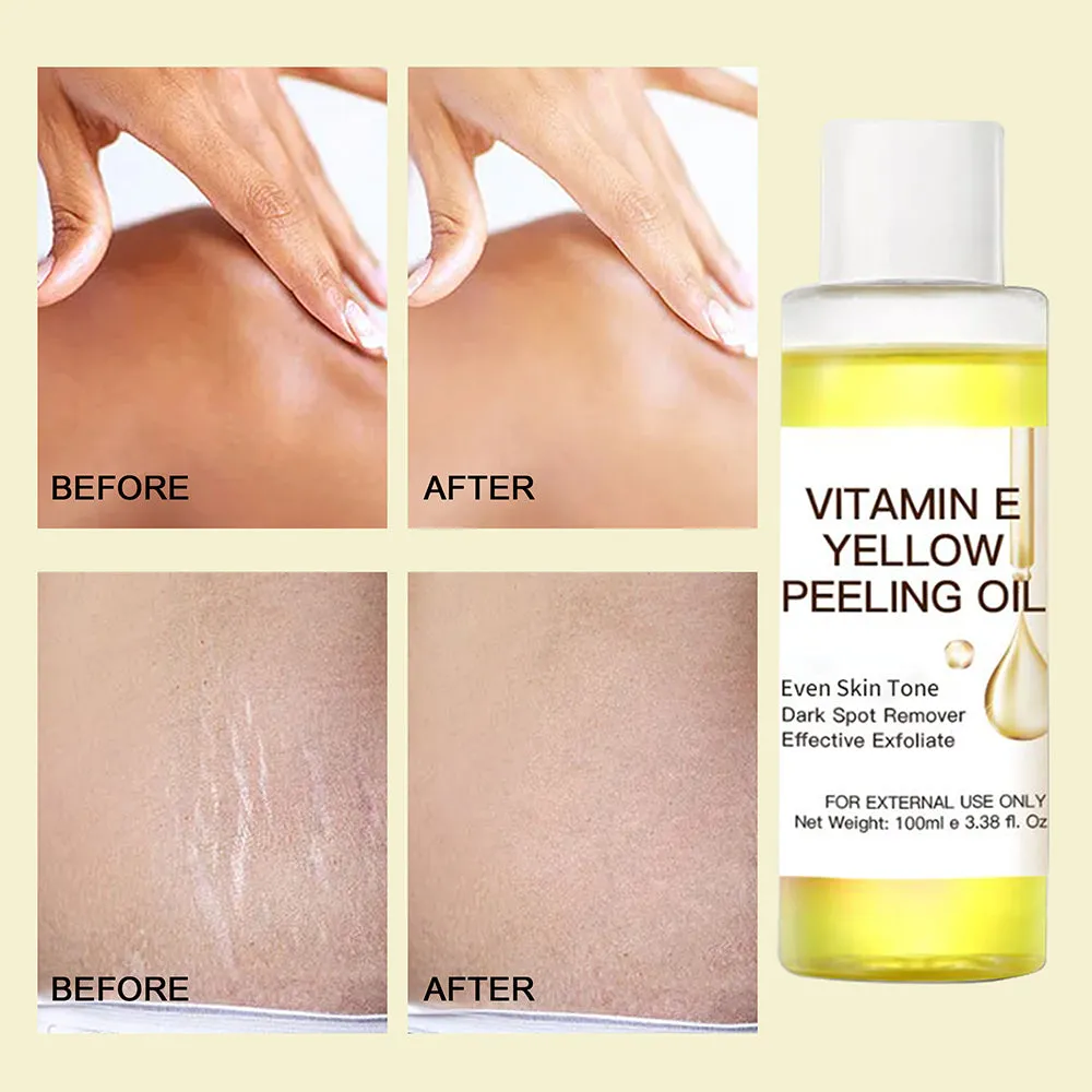 Aesthtany - Vitamin E Hair Removal Wax